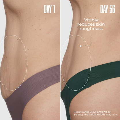 LOVILDS™🔥Special Price Only Today!!!🏆️ Clinically Proven Overnight Toning Whip