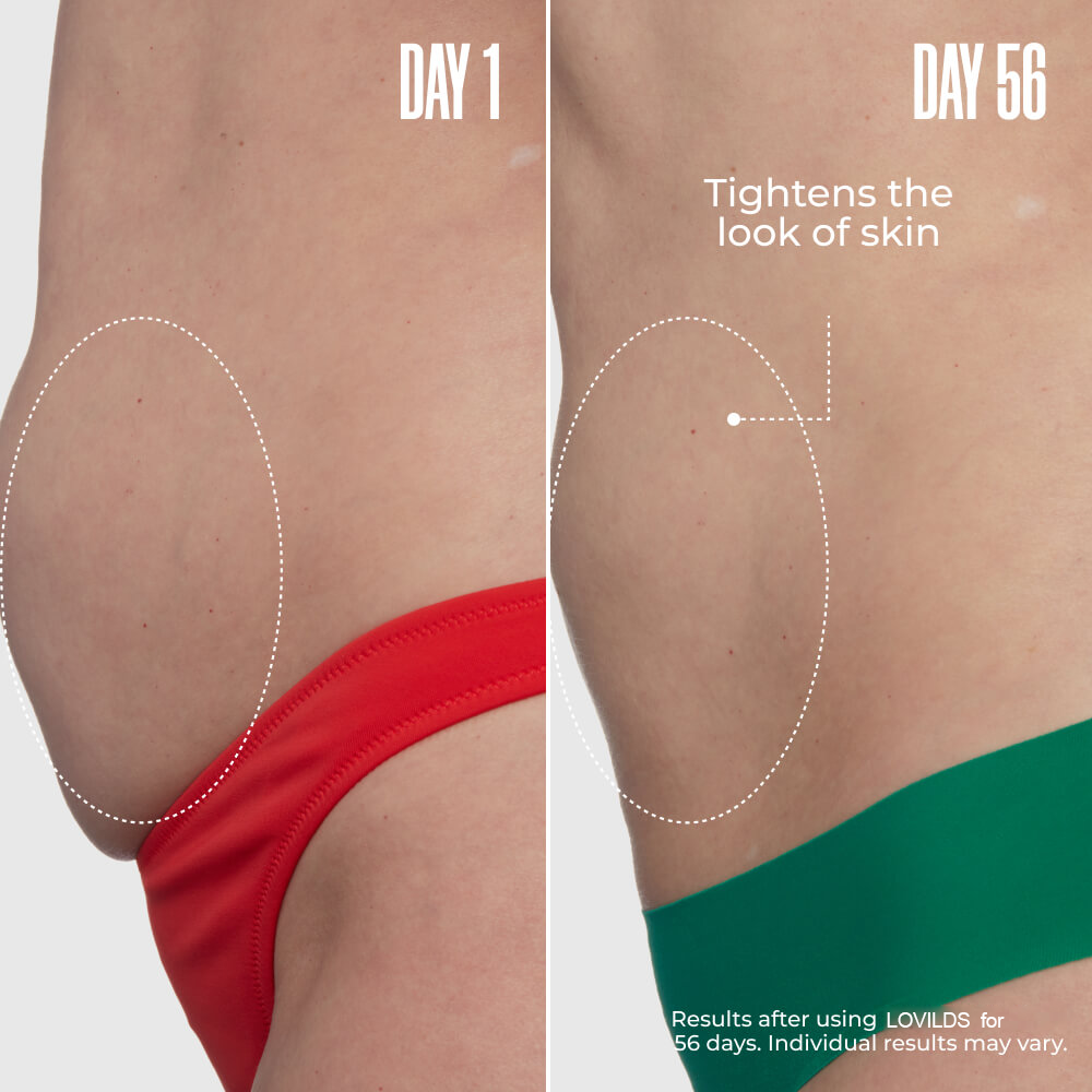 LOVILDS™🔥Special Price Only Today!!!🏆️ Clinically Proven Overnight Toning Whip
