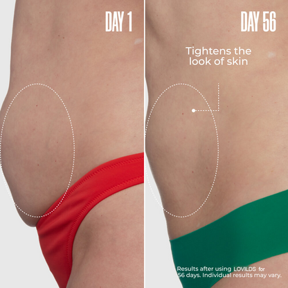 LOVILDS™🔥Special Price Only Today!!!🏆️ Clinically Proven Overnight Toning Whip