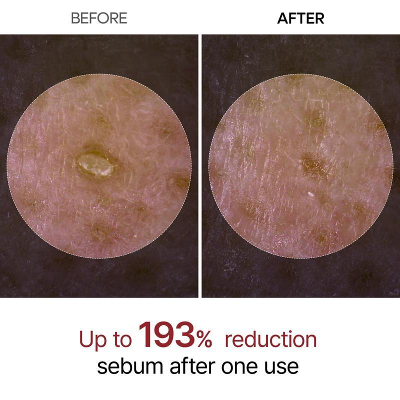(🔥Limited Time 50% OFF) LOVILDS™ AMPOULES DESIGNED JUST FOR PORES