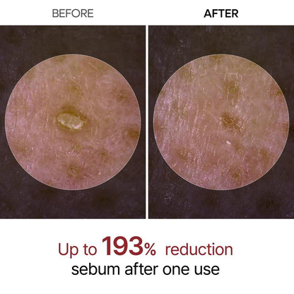 (🔥Limited Time 50% OFF) LOVILDS™ AMPOULES DESIGNED JUST FOR PORES