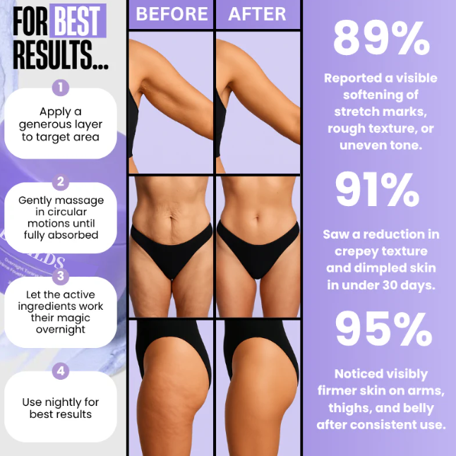 LOVILDS™🔥Special Price Only Today!!!🏆️ Clinically Proven Overnight Toning Whip