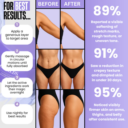 LOVILDS™🔥Special Price Only Today!!!🏆️ Clinically Proven Overnight Toning Whip